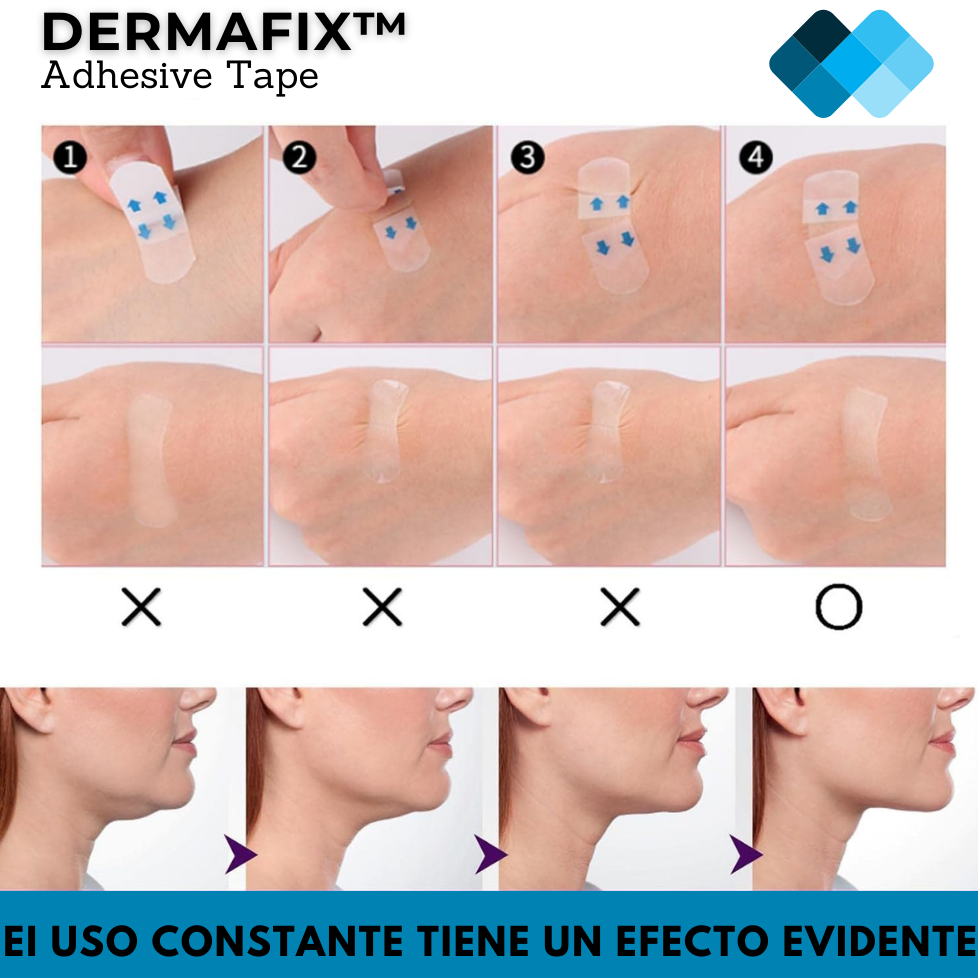 Derm - Tiras de Lifting Facial Anti-edad (40 Unidades x Pack)