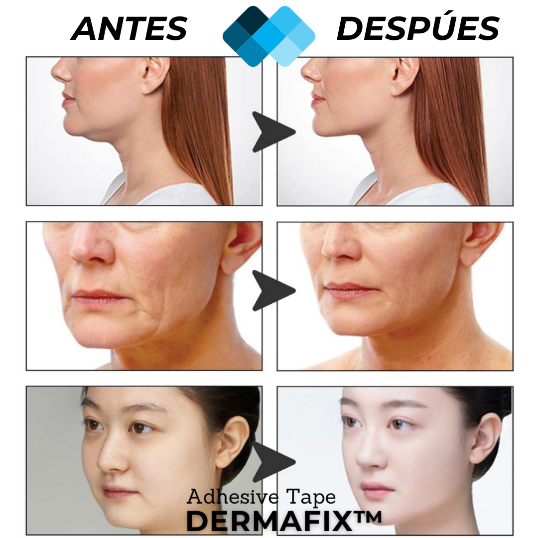 Derm - Tiras de Lifting Facial Anti-edad (40 Unidades x Pack)